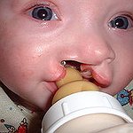 BucketList + Volunteer On Operation Smile's Medical ... = ✓