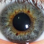 BucketList + Get Corrective Eye Surgery = ✓