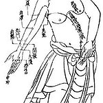 BucketList + Have Acupuncture = ✓