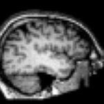 BucketList + Go Through Mri = ✓