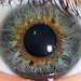BucketList + Get Corrective Eye Surgery = ✓
