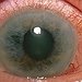 BucketList + Raise Money For Glaucoma Research ... = ✓