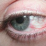 BucketList + Get Laser Eye Surgery = ✓