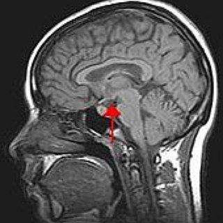BucketList + Go To University For Psychology