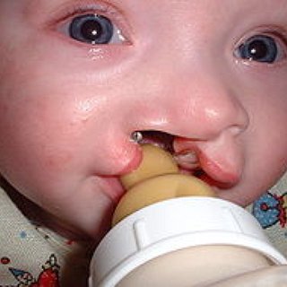BucketList + Volunteer On Operation Smile's Medical Misson