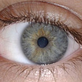 BucketList + Have Lazor Eye Surgery